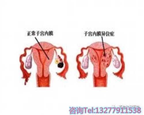 2026年南京热门供卵试管医院排名与13周NT性别差异解析